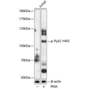 Western blot analysis of lysates from Jurkat cells, using Phospho-Pyk2-Y402 Antibody at 1/1000 dilution. Jurkat cells were treated by PMA/TPA (200nM) for 10 minutes. Secondary antibody: HRP-conjugated Goat anti-Rabbit IgG (H+L) at 1/10000 dilution. Lysates/proteins: 25 µg per lane. Blocking buffer: 3% BSA. Exposure time: 90s.