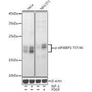 Western blot analysis of various lysates using Phospho-eIF4EBP1-T37/46 Antibody at 1/1000 dilution. HeLa cells were treated by IGF-1 (50 ng/ml) at 37 °C for 30 minutes after serum-starvation overnight. NIH/3T3 cells were treated by PDGF (100 ng/ml) at 37 °C for 30 minutes after serum-starvation overnight. Secondary antibody: HRP-conjugated Goat anti-Rabbit IgG (H+L) at 1/10000 dilution. Lysates/proteins: 25 µg per lane. Blocking buffer: 3% nonfat dry milk in TBST. Exposure time: 30s.