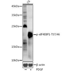 EIF4EBP1 (pT36) Antibody