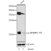 Western blot analysis of lysates from HeLa cells, using Phospho-eIF4EBP1-T70 Antibody at 1/2000 dilution. HeLa cells were treated by Insulin (100 nM) at 37 °C for 5 minutes after serum-starvation overnight. Secondary antibody: HRP-conjugated Goat anti-Rabbit IgG (H+L) at 1/10000 dilution. Lysates/proteins: 25 µg per lane. Blocking buffer: 3% BSA. Exposure time: 3min.