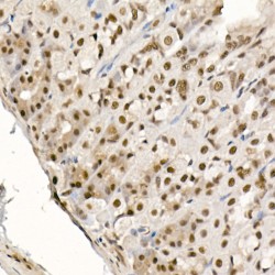 EIF4EBP1 (pT69) Antibody