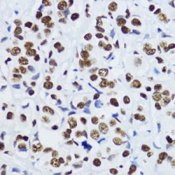 Histone H3 Acetyl-Lys9 (H3 AcK9) Antibody