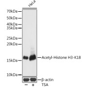 Western blot analysis of lysates from HeLa cells using Acetyl-Histone H3-K18 Antibody at 1/1000 dilution. HeLa cells were treated by TSA (1 uM) at 37 °C for 18 hours. Secondary antibody: HRP-conjugated Goat anti-Rabbit IgG (H+L) at 1/10000 dilution. Lysates/proteins: 25 µg per lane. Blocking buffer: 3% nonfat dry milk in TBST. Exposure time: 0.5s.