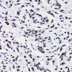 Histone H3 Acetyl-Lys18 (H3 AcK18) Antibody