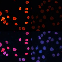 Histone H3 Acetyl-Lys18 (H3 AcK18) Antibody