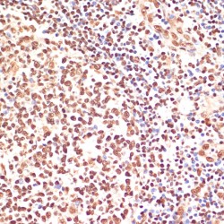 Poly ADP Ribose Polymerase (PARP) Antibody