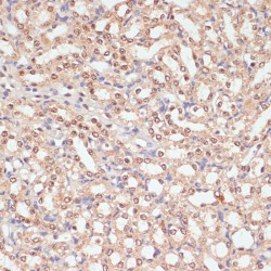 Poly ADP Ribose Polymerase (PARP) Antibody