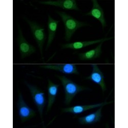 Poly ADP Ribose Polymerase (PARP) Antibody
