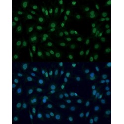 Poly ADP Ribose Polymerase (PARP) Antibody