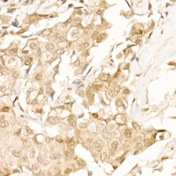 beta Catenin (CTNNB1) Antibody