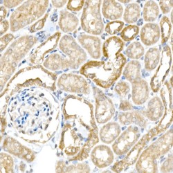 Beta-Secretase 1 (BACE1) Antibody