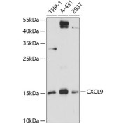 Western blot analysis of various lysates using CXCL9 Antibody at 1/3000 dilution. Secondary antibody: HRP-conjugated Goat anti-Rabbit IgG (H+L) at 1/10000 dilution. Lysates/proteins: 25 µg per lane. Blocking buffer: 3% nonfat dry milk in TBST. Exposure time: 90s.