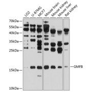 Western blot analysis of various lysates using GMFB Antibody at 1/1000 dilution. Secondary antibody: HRP-conjugated Goat anti-Rabbit IgG (H+L) at 1/10000 dilution. Lysates/proteins: 25 µg per lane. Blocking buffer: 3% nonfat dry milk in TBST. Exposure time: 30s.