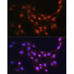 Glia Maturation Factor Beta (GMFB) Antibody