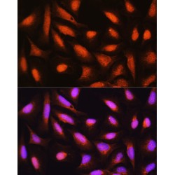 Glia Maturation Factor Beta (GMFB) Antibody