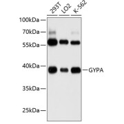abx123499