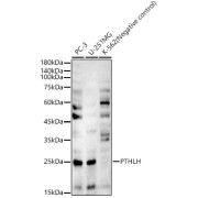 Western blot analysis of various lysates, using PTHLH Antibody at 1/8000 dilution. Secondary antibody: HRP-conjugated Goat anti-Rabbit IgG (H+L) at 1/10000 dilution. Lysates/proteins: 25 µg per lane. Blocking buffer: 3% nonfat dry milk in TBST. Exposure time: 90s.