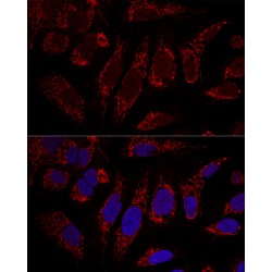 Coiled-Coil-Helix-Coiled-Coil-Helix Domain Containing 3 (CHCHD3) Antibody