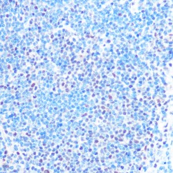 Small Nuclear Ribonucleoprotein Polypeptides B And B1 (SNRPB) Antibody