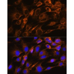 Aquaporin 8 (AQP8) Antibody