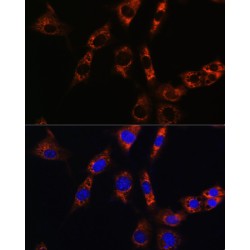 Aquaporin 8 (AQP8) Antibody