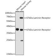 Western blot analysis of various lysates using 67kDa Laminin Receptor Antibody at 1/3000 dilution. Secondary antibody: HRP-conjugated Goat anti-Rabbit IgG (H+L) at 1/10000 dilution. Lysates/proteins: 25 µg per lane. Blocking buffer: 3% nonfat dry milk in TBST. Exposure time: 90s.