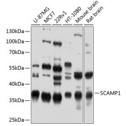 Western blot analysis of various lysates using SCAMP1 Antibody at 1/1000 dilution. Secondary antibody: HRP-conjugated Goat anti-Rabbit IgG (H+L) at 1/10000 dilution. Lysates/proteins: 25 µg per lane. Blocking buffer: 3% nonfat dry milk in TBST. Exposure time: 1s.