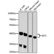 Western blot analysis of various lysates using IST1 Antibody at 1/3000 dilution. Secondary antibody: HRP-conjugated Goat anti-Rabbit IgG (H+L) at 1/10000 dilution. Lysates/proteins: 25 µg per lane. Blocking buffer: 3% nonfat dry milk in TBST. Exposure time: 90s.