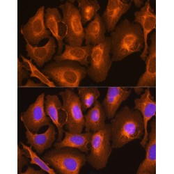 HLA class I histocompatibility antigen, C alpha chain (HLA-C) Antibody