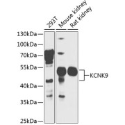 Western blot analysis of various lysates using KCNK9 Antibody at 1/1000 dilution. Secondary antibody: HRP-conjugated Goat anti-Rabbit IgG (H+L) at 1/10000 dilution. Lysates/proteins: 25 µg per lane. Blocking buffer: 3% nonfat dry milk in TBST. Exposure time: 15s.