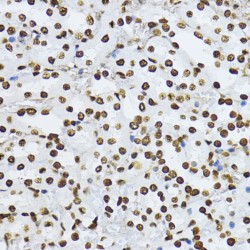 SMAD3 (pT179) Antibody