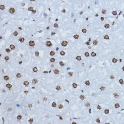 SMAD3 (pT179) Antibody