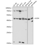 Western blot analysis of various lysates using GCDH Antibody at 1/1000 dilution. Secondary antibody: HRP-conjugated Goat anti-Rabbit IgG (H+L) at 1/10000 dilution. Lysates/proteins: 25 µg per lane. Blocking buffer: 3% nonfat dry milk in TBST. Exposure time: 30s.