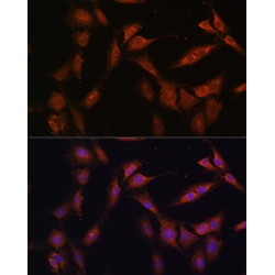 6-Phosphofructo-2-Kinase/Fructose-2,6-Biphosphatase 2 (PFKFB2) Antibody