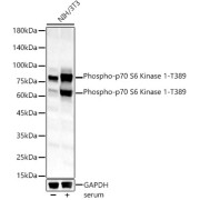 Western blot analysis of lysates from NIH/3T3 cells, using Phospho-p70 S6 Kinase 1-T389 Antibody at 1/1000 dilution. NIH/3T3 cells were treated by 10% FBS at 37 °C for 30 minutes after serum-starvation overnight. Secondary antibody: HRP-conjugated Goat anti-Rabbit IgG (H+L) at 1/10000 dilution. Lysates/proteins: 25 µg per lane. Blocking buffer: 3% nonfat dry milk in TBST. Exposure time: 180s.