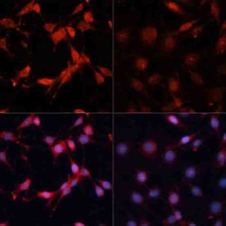 P70S6K1 (pT389) Antibody
