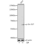 Western blot analysis of lysates from 293T cells, using Phospho-Src-S17 Antibody at 1/1000 dilution. 293T cells were treated by CIP(20uL/400ul) at 37 °C for 1 hour. Secondary antibody: HRP-conjugated Goat anti-Rabbit IgG (H+L) at 1/10000 dilution. Lysates/proteins: 25 µg per lane. Blocking buffer: 3% nonfat dry milk in TBST. Exposure time: 180s.