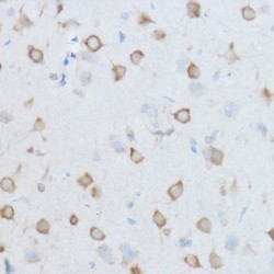 T-Complex Protein 1 Subunit Theta (CCT8) Antibody