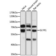 Western blot analysis of various lysates using GLYR1 Antibody at 1/1000 dilution. Secondary antibody: HRP-conjugated Goat anti-Rabbit IgG (H+L) at 1/10000 dilution. Lysates/proteins: 25 µg per lane. Blocking buffer: 3% nonfat dry milk in TBST. Exposure time: 5s.
