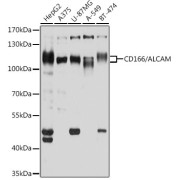 Western blot analysis of various lysates using CD166/ALCAM Antibody at 1/1000 dilution. Secondary antibody: HRP-conjugated Goat anti-Rabbit IgG (H+L) at 1/10000 dilution. Lysates/proteins: 25 µg per lane. Blocking buffer: 3% nonfat dry milk in TBST. Exposure time: 5s.