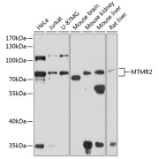 Western blot analysis of various lysates using MTMR2 Antibody at 1/1000 dilution. Secondary antibody: HRP-conjugated Goat anti-Rabbit IgG (H+L) at 1/10000 dilution. Lysates/proteins: 25 µg per lane. Blocking buffer: 3% nonfat dry milk in TBST. Exposure time: 30s.