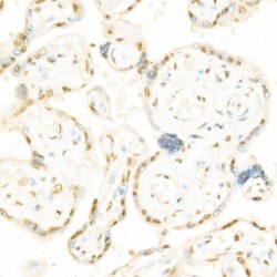 RAF1 (phospho-pS338) Antibody