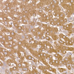 NUMB, Endocytic Adaptor Protein (NUMB) Antibody