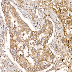 NUMB, Endocytic Adaptor Protein (NUMB) Antibody