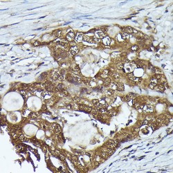 Fermitin Family Homolog 2 (FERMT2) Antibody