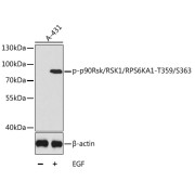Western blot analysis of lysates from A431 cells, using Phospho-p90Rsk/RSK1/RPS6KA1-T359/S363 Antibody. Secondary antibody: HRP-conjugated Goat anti-Rabbit IgG (H+L) at 1/10000 dilution. Lysates/proteins: 25 µg per lane. Blocking buffer: 3% BSA.