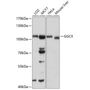 Western blot analysis of various lysates using GGCX Antibody at 1/1000 dilution. Secondary antibody: HRP-conjugated Goat anti-Rabbit IgG (H+L) at 1/10000 dilution. Lysates/proteins: 25 µg per lane. Blocking buffer: 3% nonfat dry milk in TBST. Exposure time: 90s.