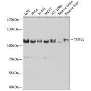 Western blot analysis of various lysates using TFIP11 Antibody at 1/1000 dilution. Secondary antibody: HRP-conjugated Goat anti-Rabbit IgG (H+L) at 1/10000 dilution. Lysates/proteins: 25 µg per lane. Blocking buffer: 3% nonfat dry milk in TBST. Exposure time: 10s.