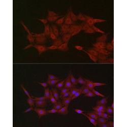 Importin Subunit Beta-1 (KPNB1) Antibody