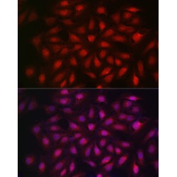 Importin Subunit Beta-1 (KPNB1) Antibody